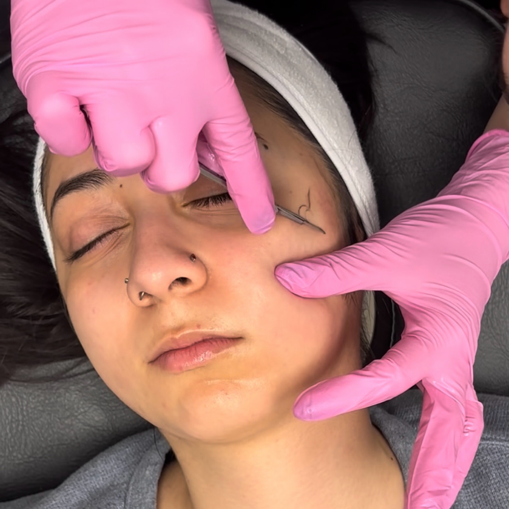 Dermaplaning at Delaneytheesti in Carson City, NV