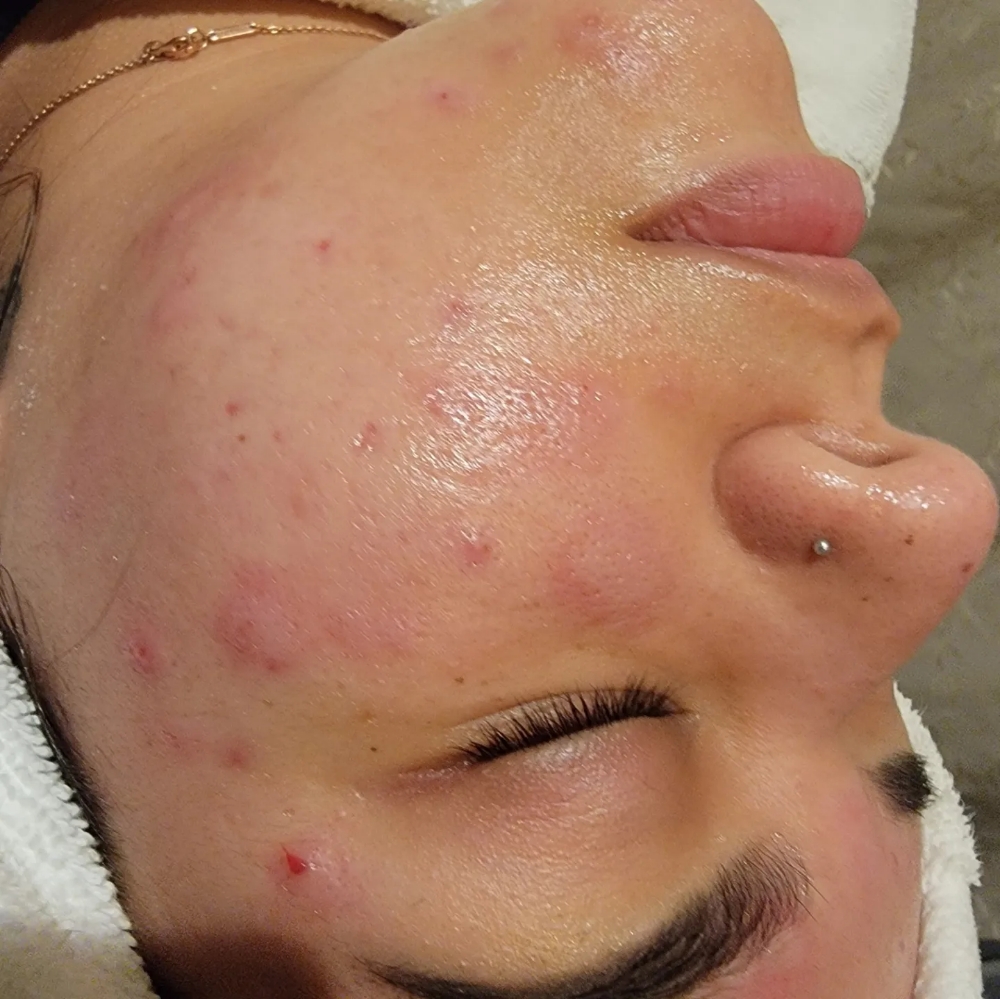 Pore Perfection Facial