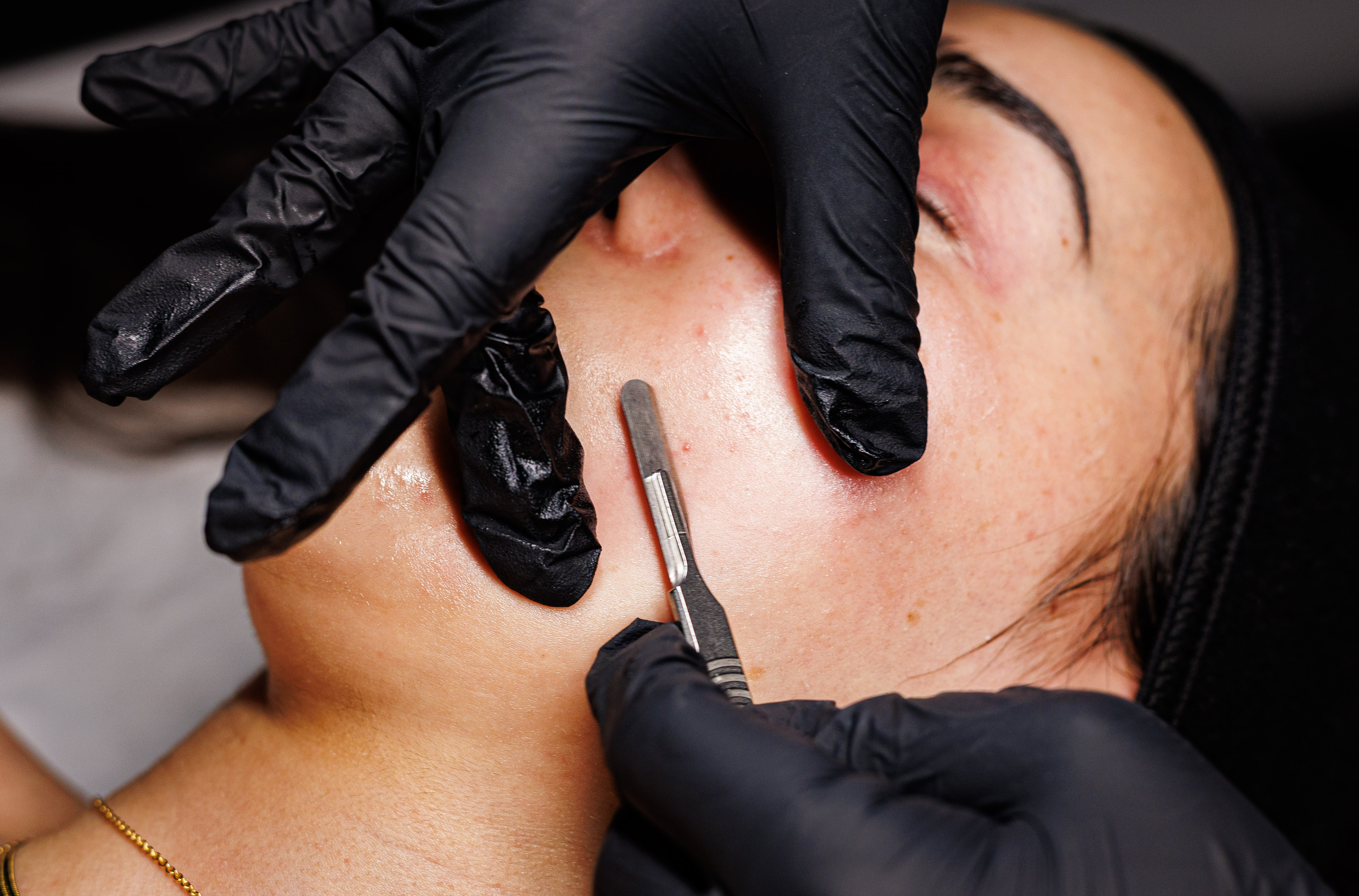 Silk Skin Treatment