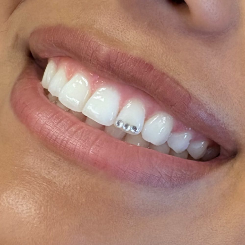 Tooth Gems at SunKissed SkinCare in Prescott Valley, AZ