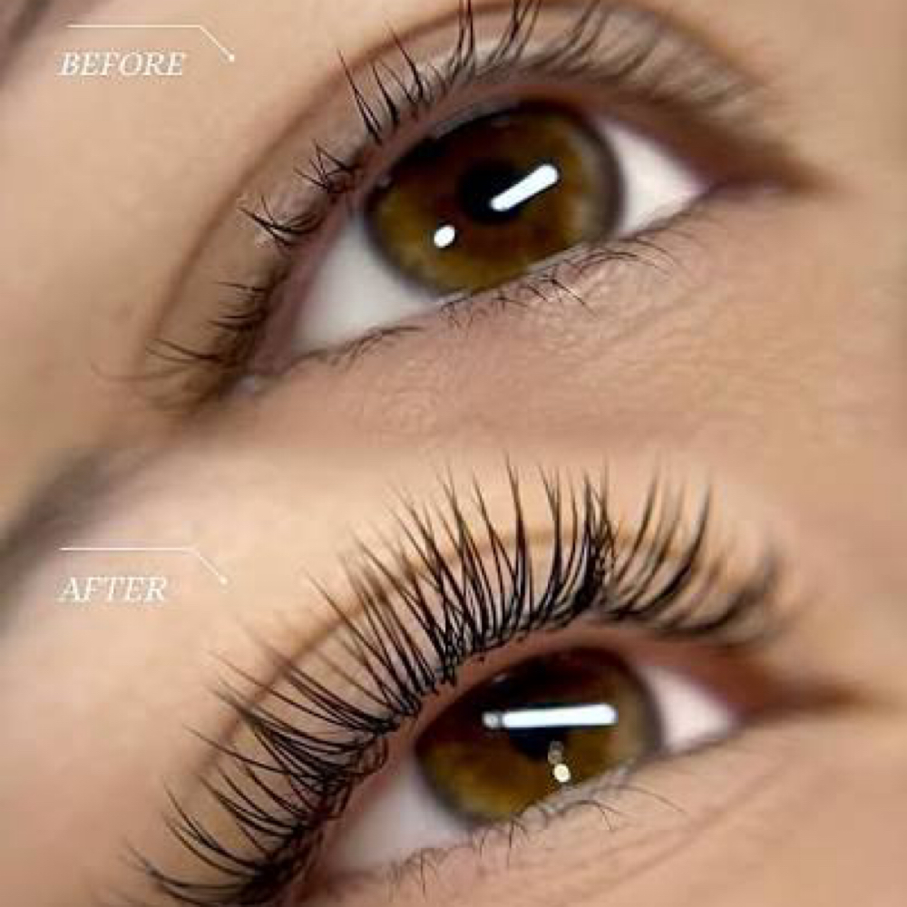 Classic (2 Week) at Aura Aesthetics in Houston, TX