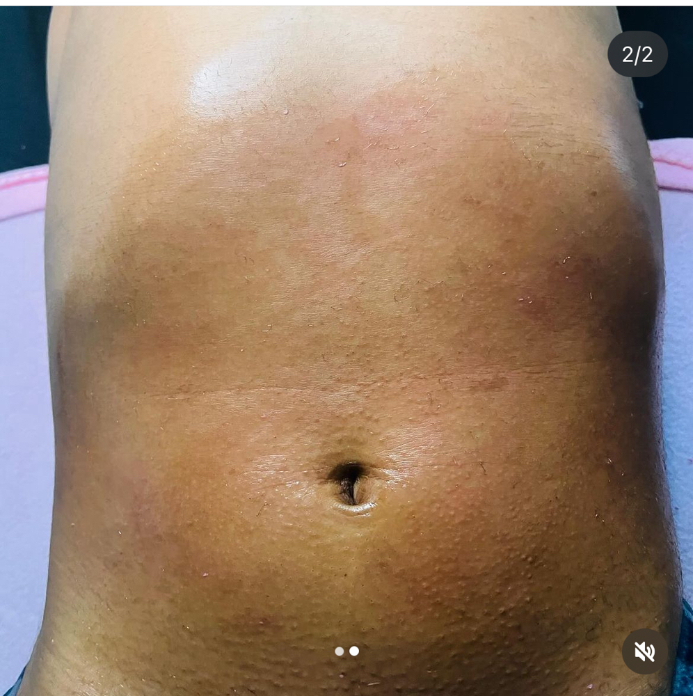 Stomach Wax at BeYou Cosmetics LLC in Columbus, OH