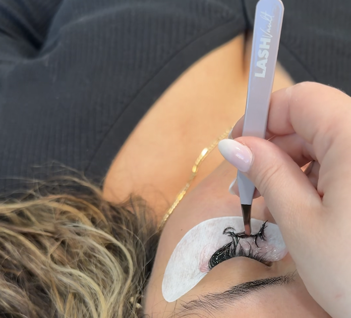 Removal at Garden Esthetics in Antioch, CA