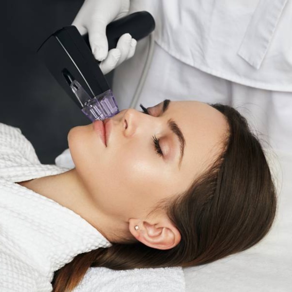 Morpheus8 - Face Microneedling