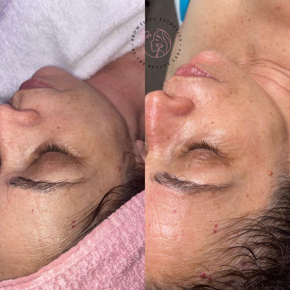 Anti Aging Facial