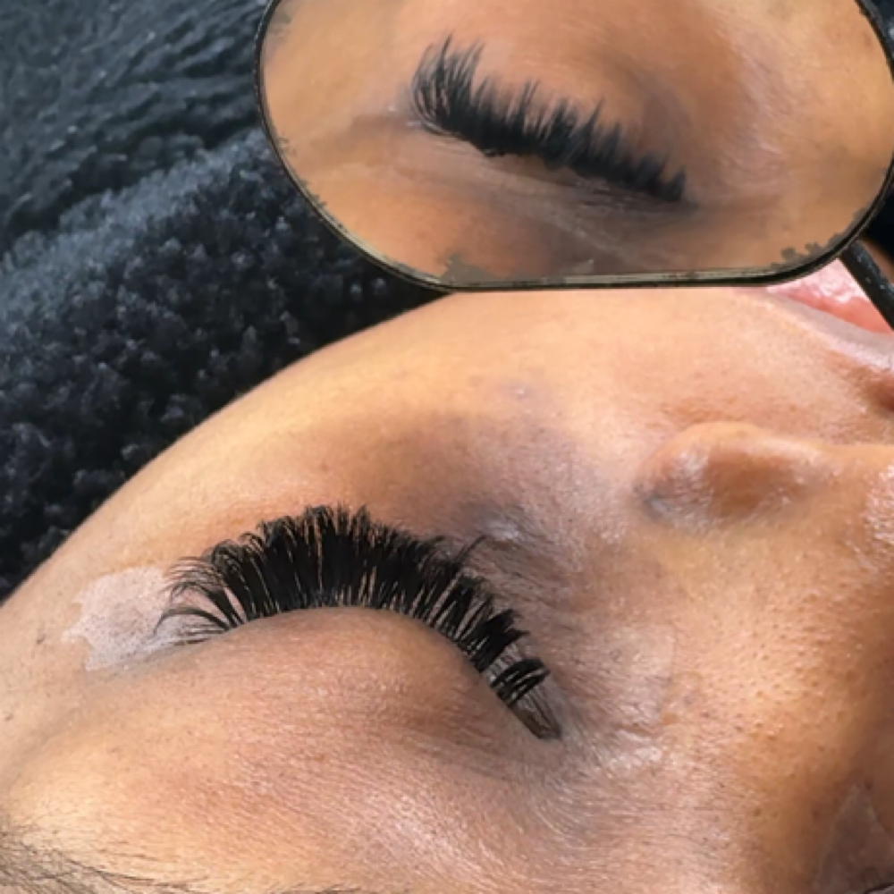 Mini Fill at Aesthetic Obsession in Fairlawn, OH