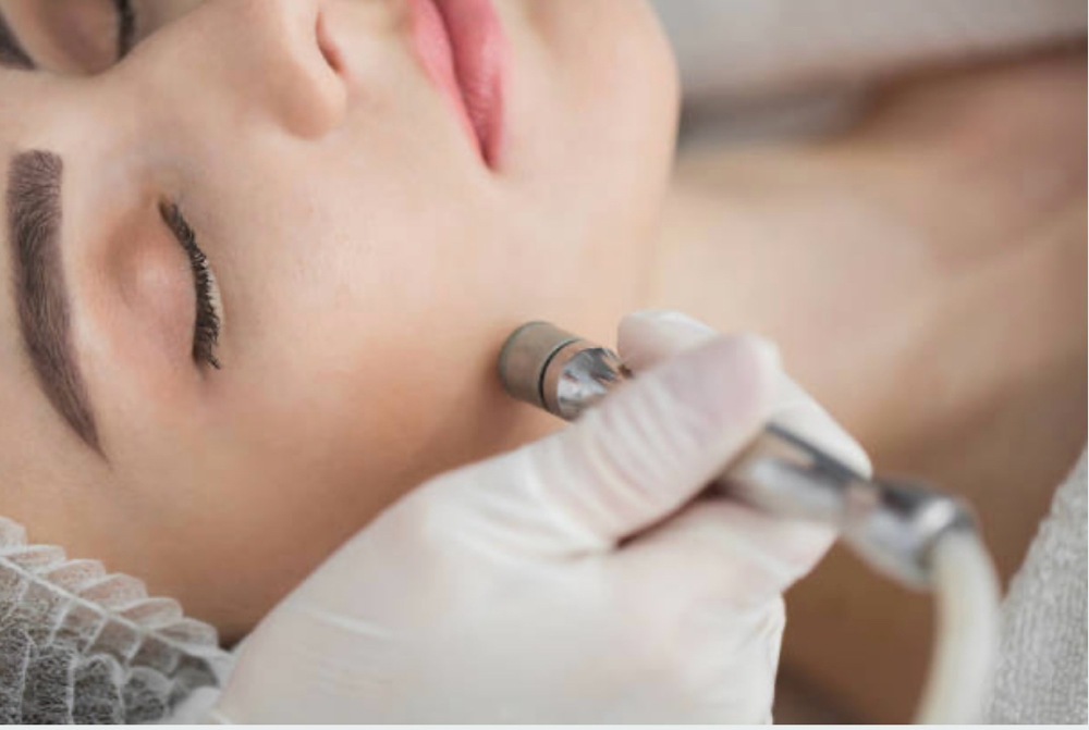 Diamond Microderm