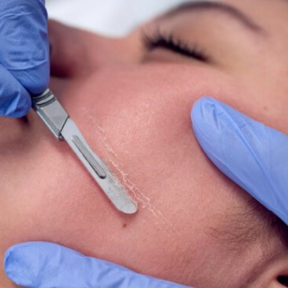 Dermaplane Add On at Novida Aesthetics in Norwell, MA