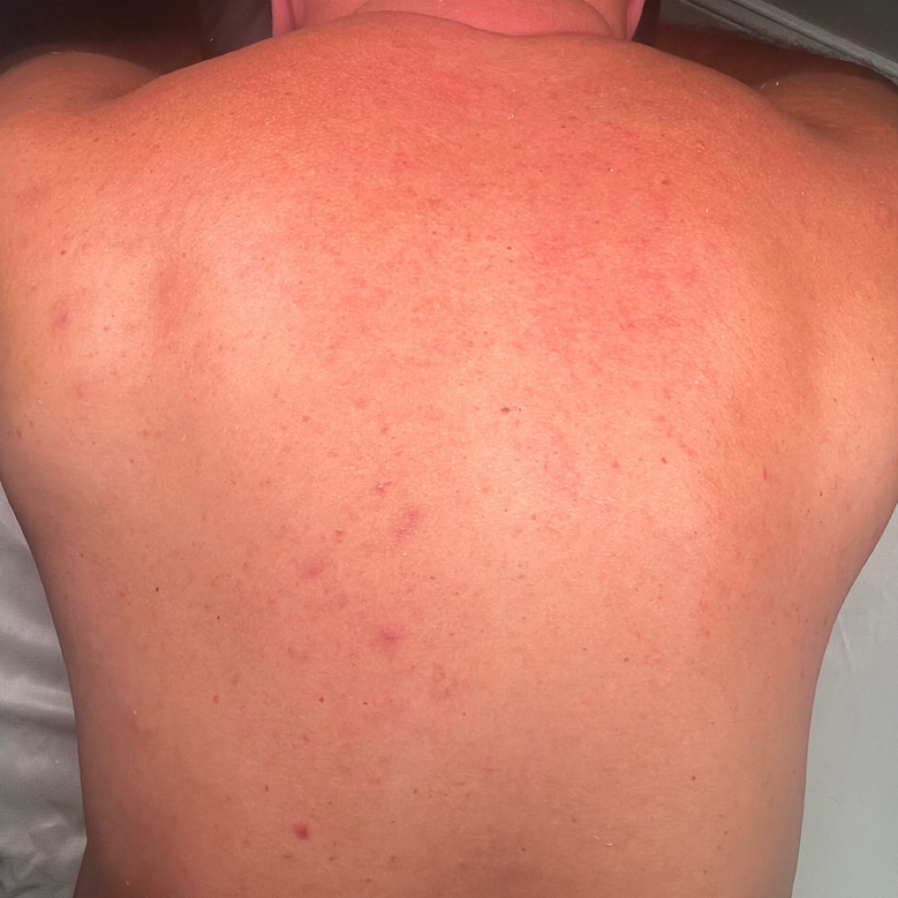 Back Wax at Skylar Ashley Aesthetics in Leitchfield, KY