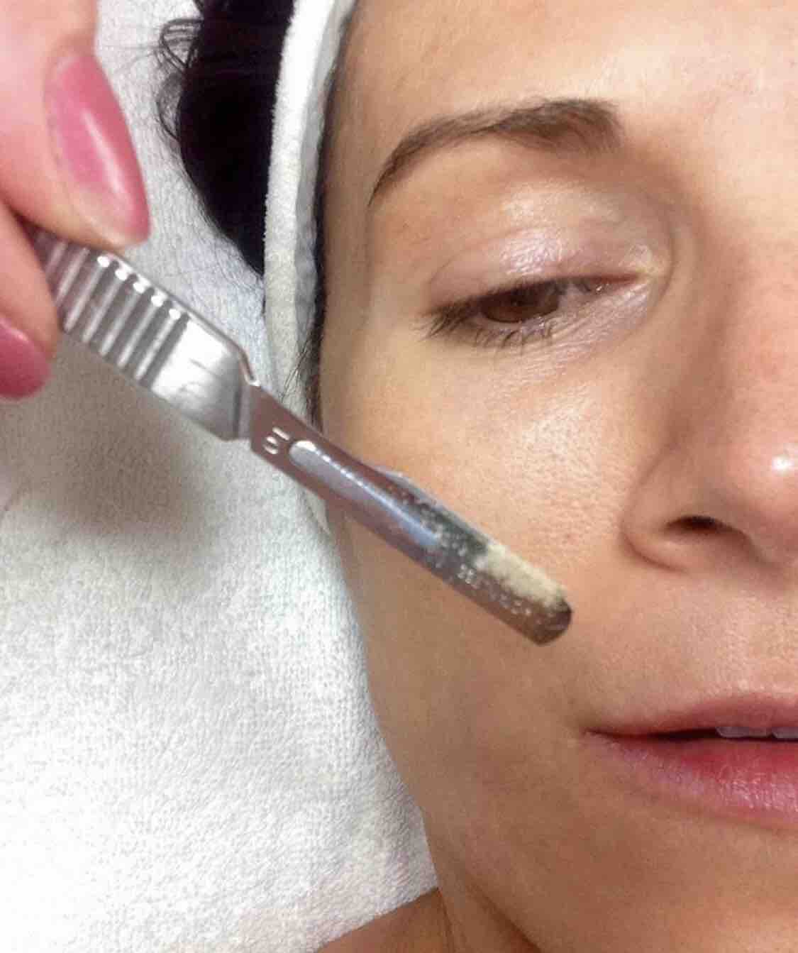 Dermaplane With Refill
