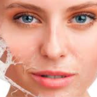 Circadia Gel Based Peel at MUSE Beauty Lounge in Taylor, TX