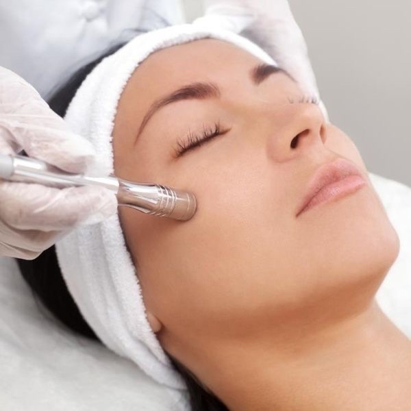 Microdermabrasion Facial