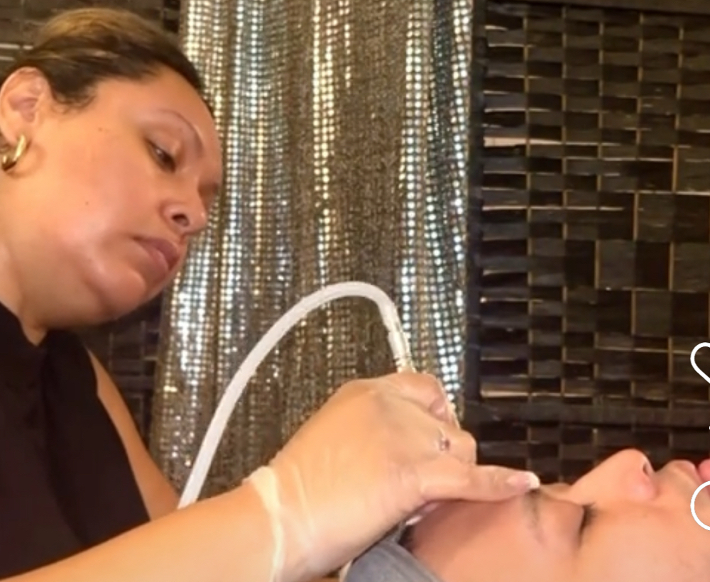 Microdermabrasion