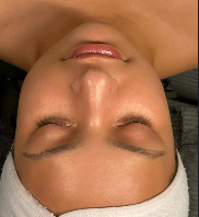 Customized Facial
