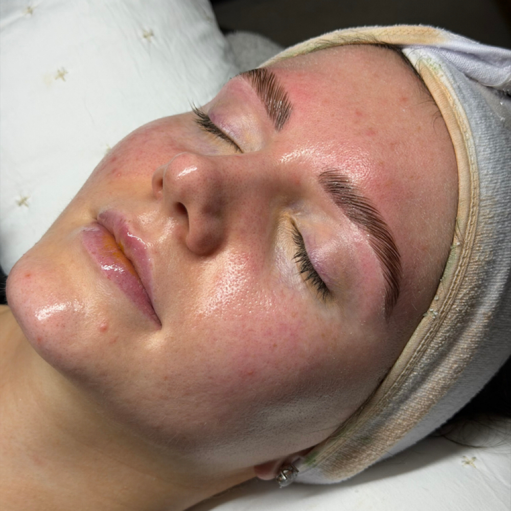 The Clean Girl Facial at Ruby Williams Aesthetics LLC in Sarasota, FL