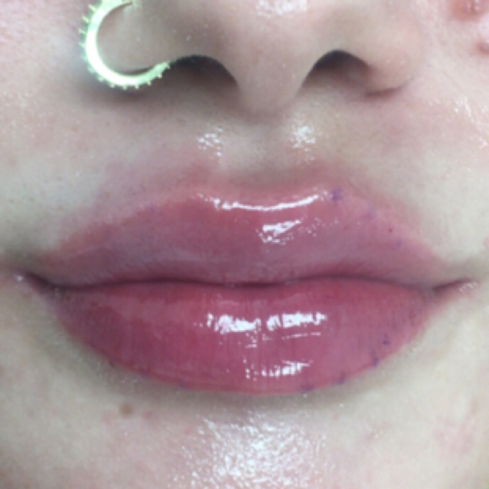 Full Suringe Lip Filler Deal$ at DopeGirlz Beauty Spa Academy in Columbus, OH