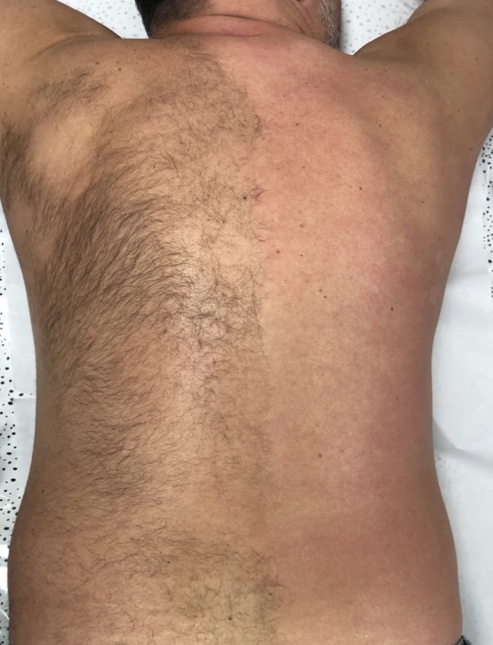 Back Wax