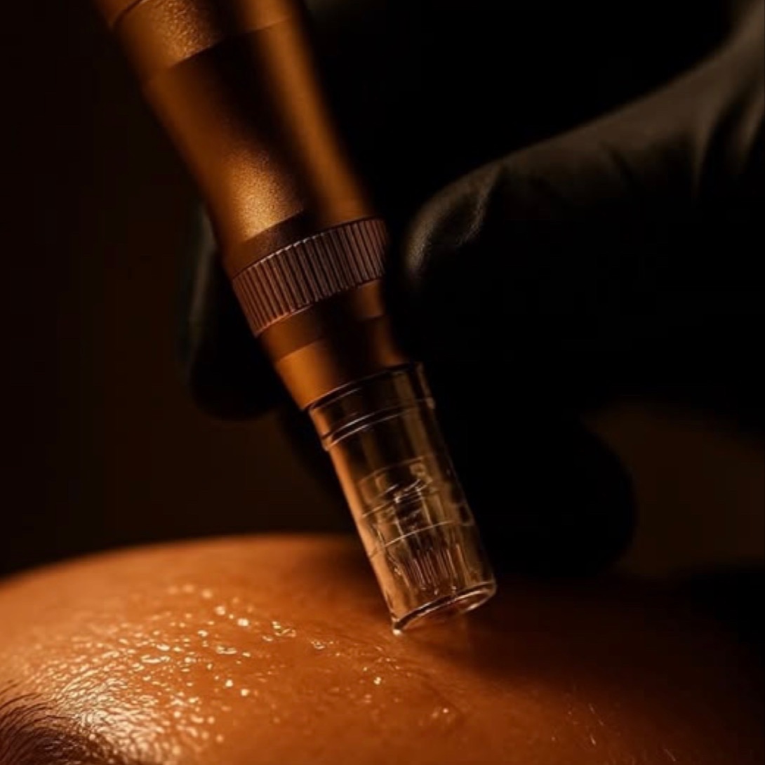 Microneedling Package (4 Sessions) at Cove Aesthetics in Lexington, VA