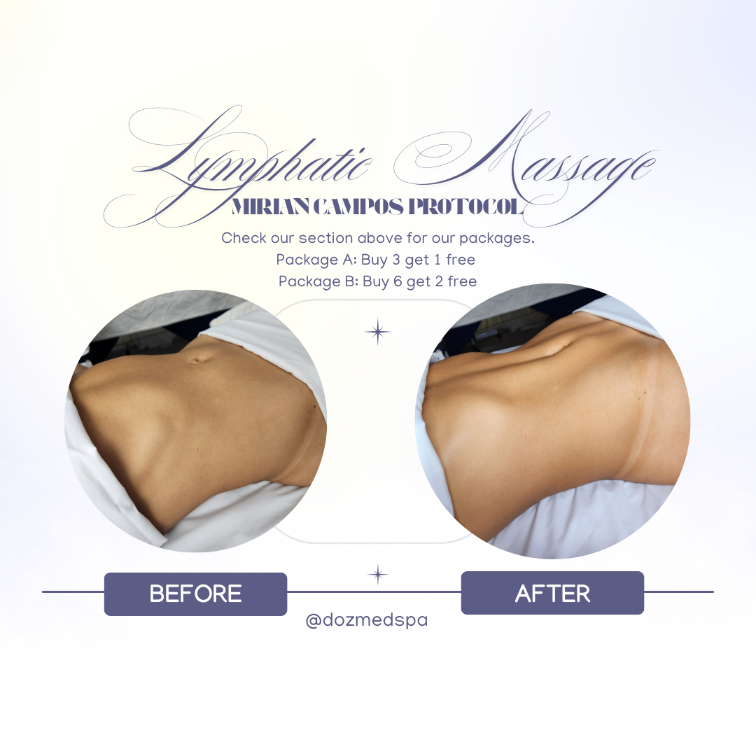 LDM - Lymphatic Drainage Therapy