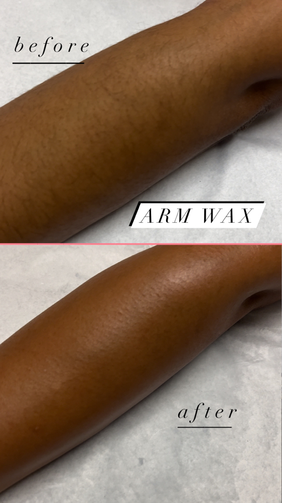 Half Arm