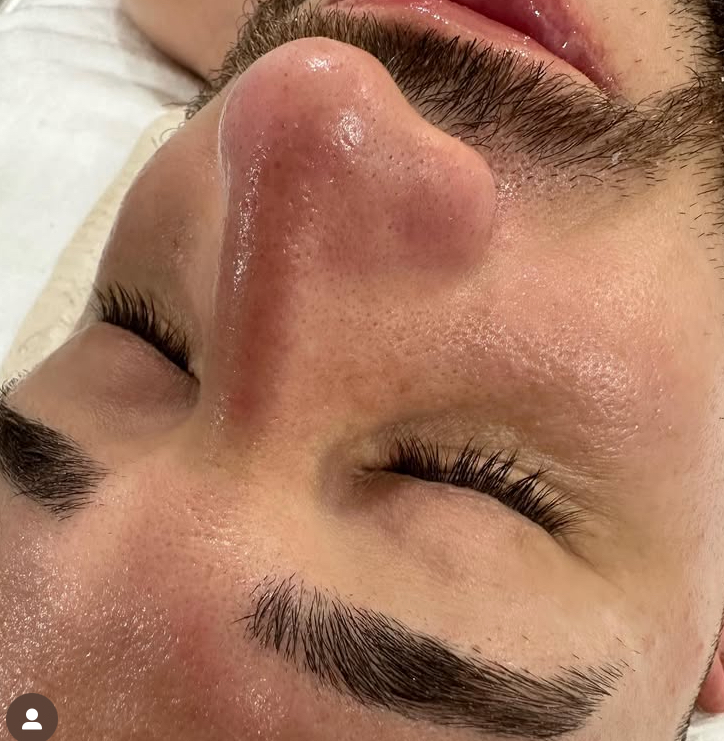 Limpeza De Pele Regula at Jessica Luchesi Skin Wellness in Elizabeth, NJ