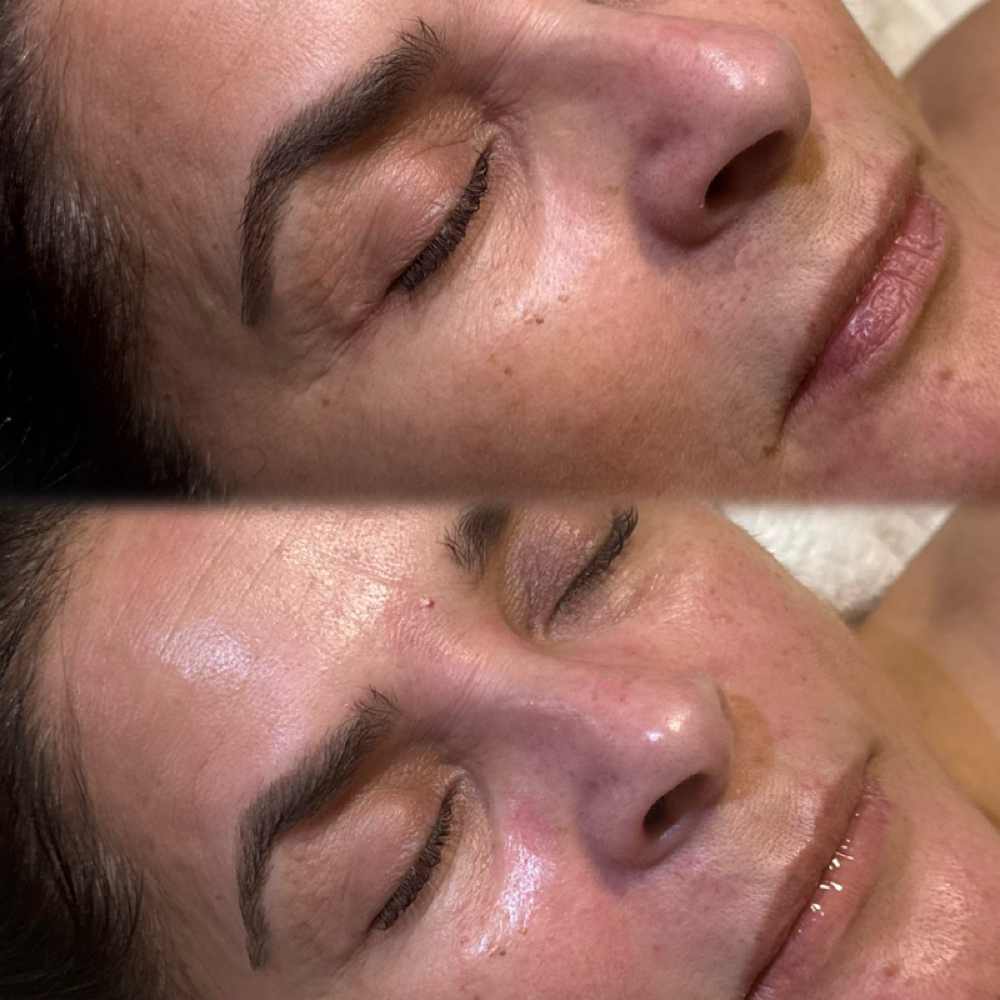 Peptide Lift at Divinely You Beauty Bar in New Caney, TX