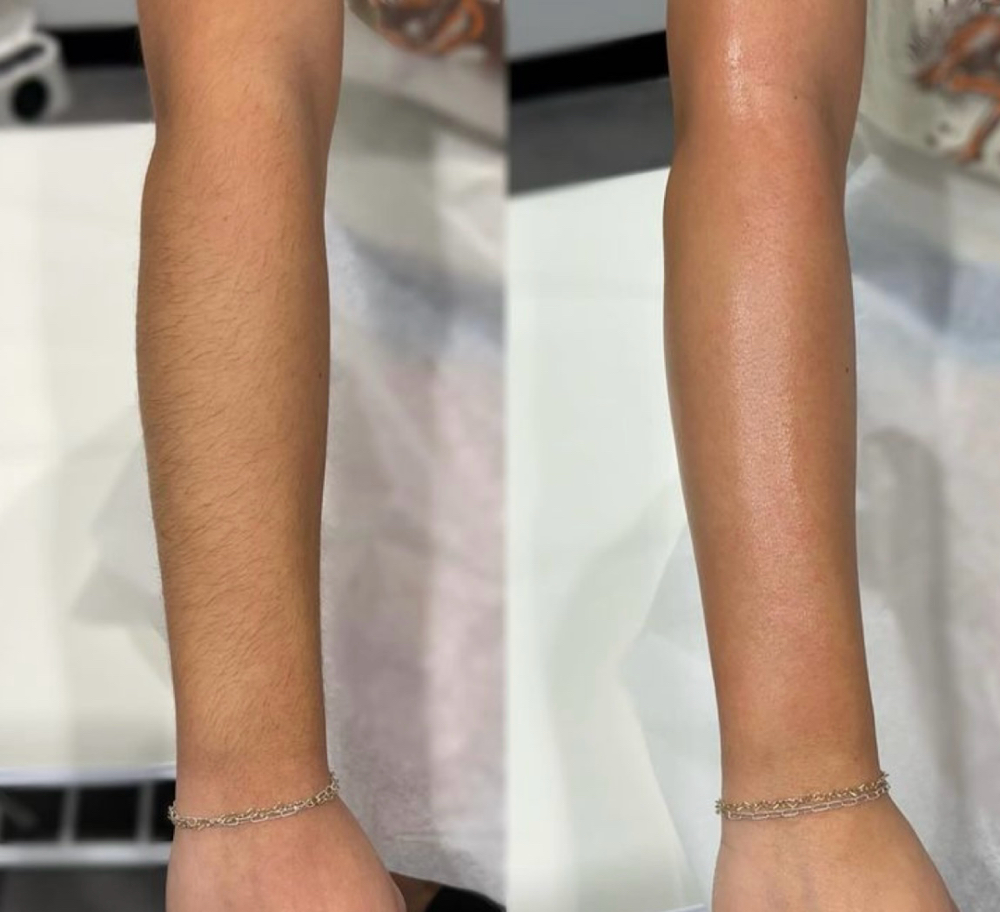 1/2 Arm Wax