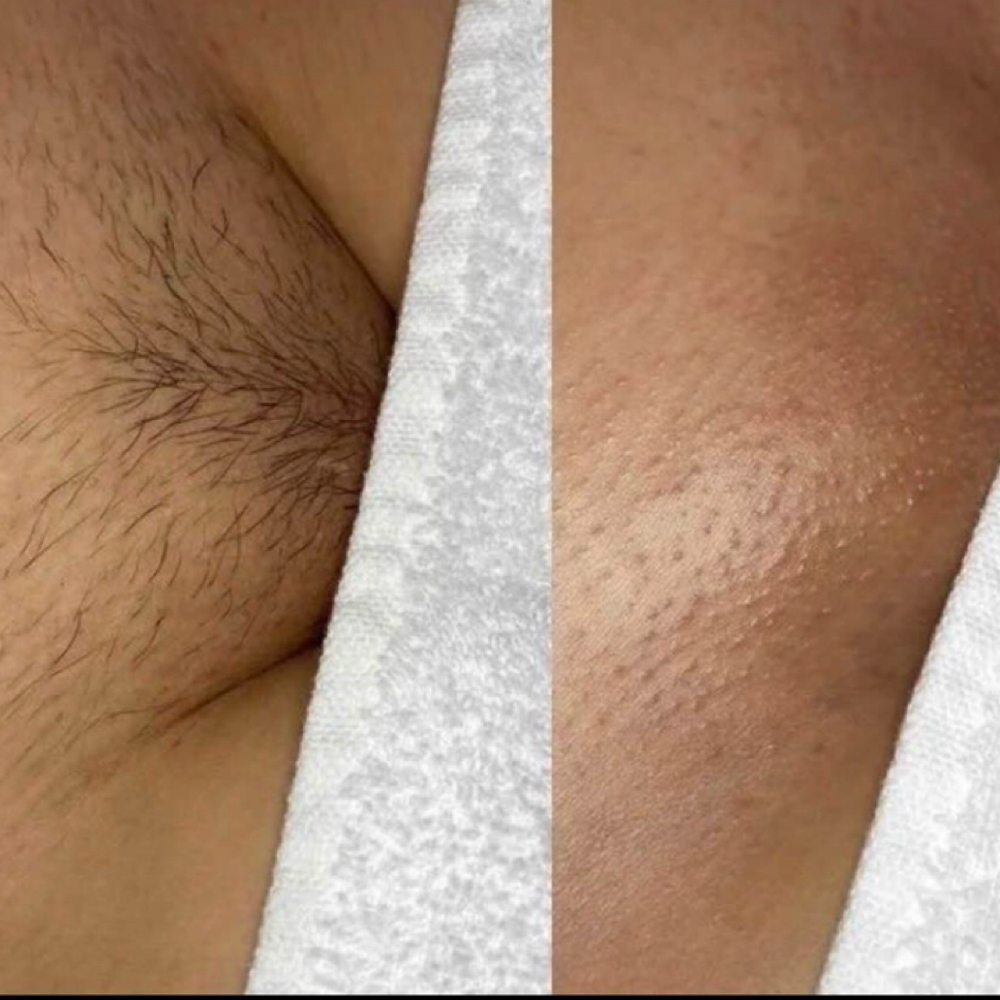 Brazilian (V) at Belladz Wax Studio in Beltsville, MD