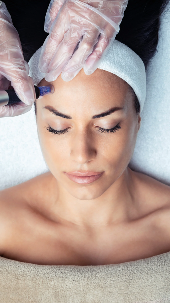 Luxe Microneedling