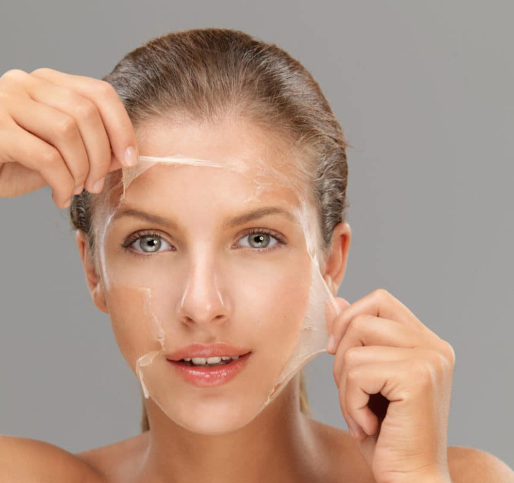Chemical Peel