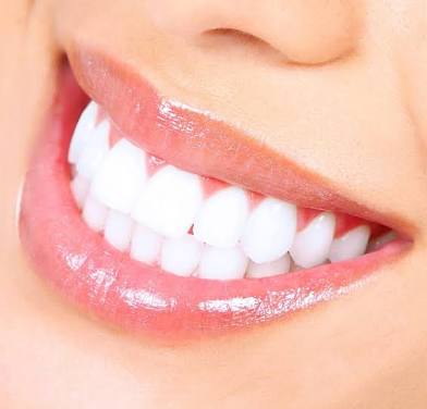 1 HR Teeth Whitening