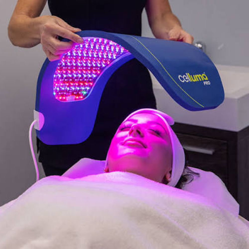 CELLUMA LED LIGHT THERAPY at REVIVED SKIN ESTHETICS in CYPRESS, CA
