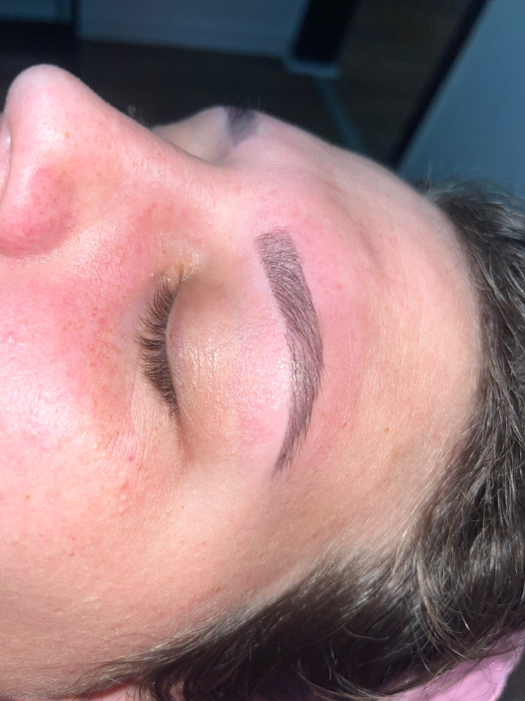 Brow Transformation