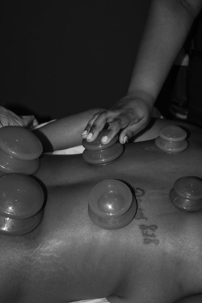 Cupping Therapy