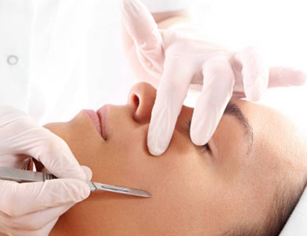 Dermaplane (Add-On)