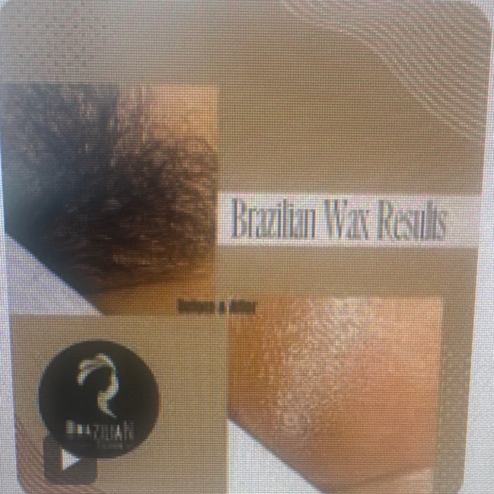 Brazillian Wax- Ladies Only at MitzSkin Beauty in Buckeye, AZ