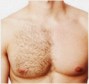 Male Waxing