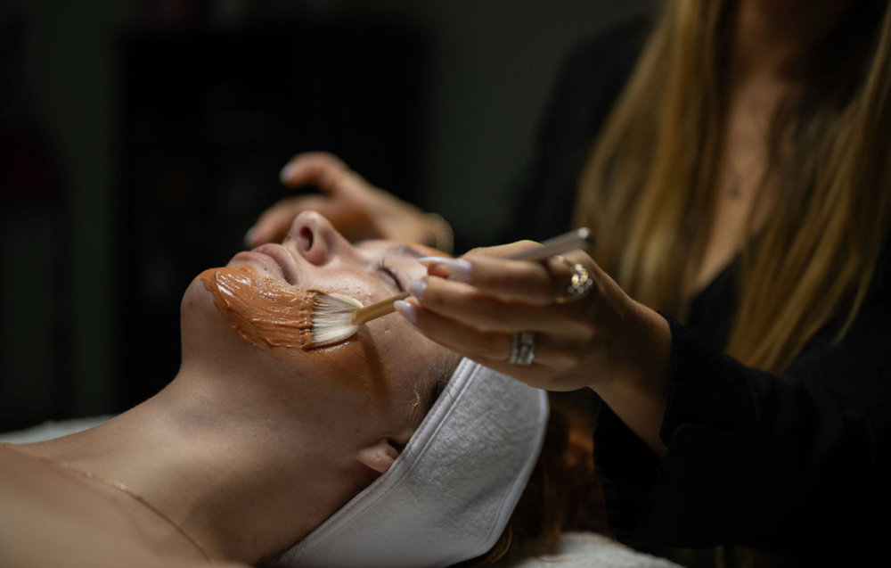 Custom Chemical Peel