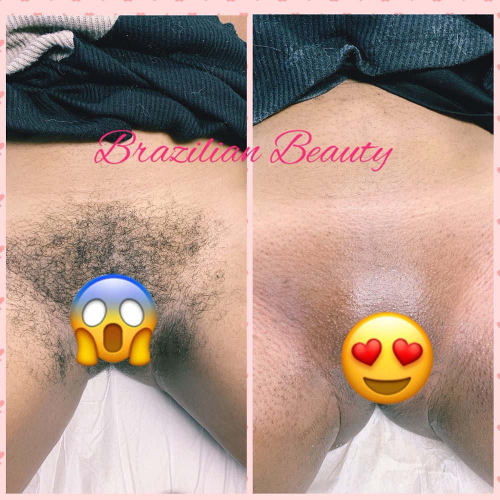 Lovely V Wax (Brazillian) at N'Vestd Aesthetics in Fairfeild, OH