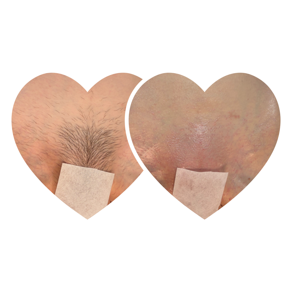 Brazilian Wax (Less Hair-Approved) at Sacred Lotus Collective LLC in Chandler, AZ