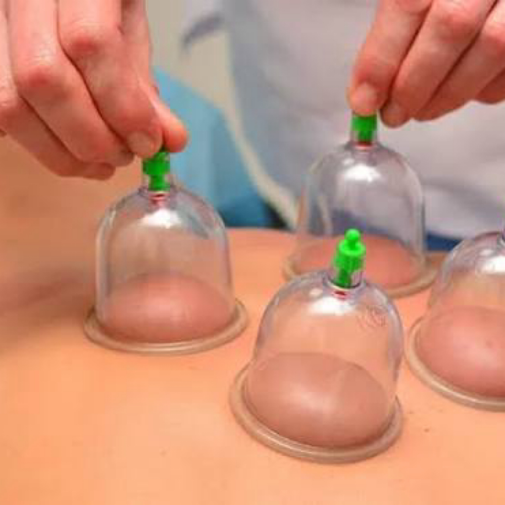 Cupping Add-on at Desert Rose Healing LLC in Prescott Valley, AZ