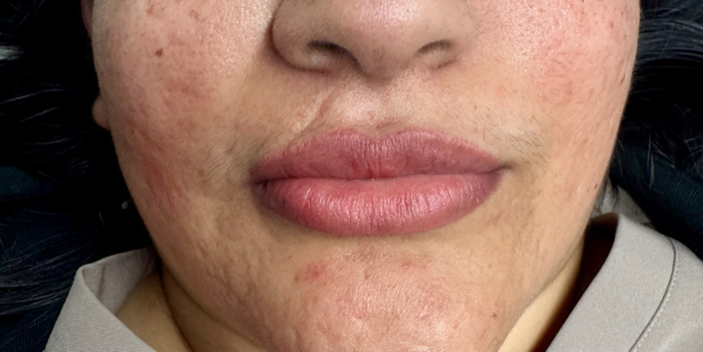 Lip Blush - 4-6 Week Touch Up at Browbladedink in Irvine, CA