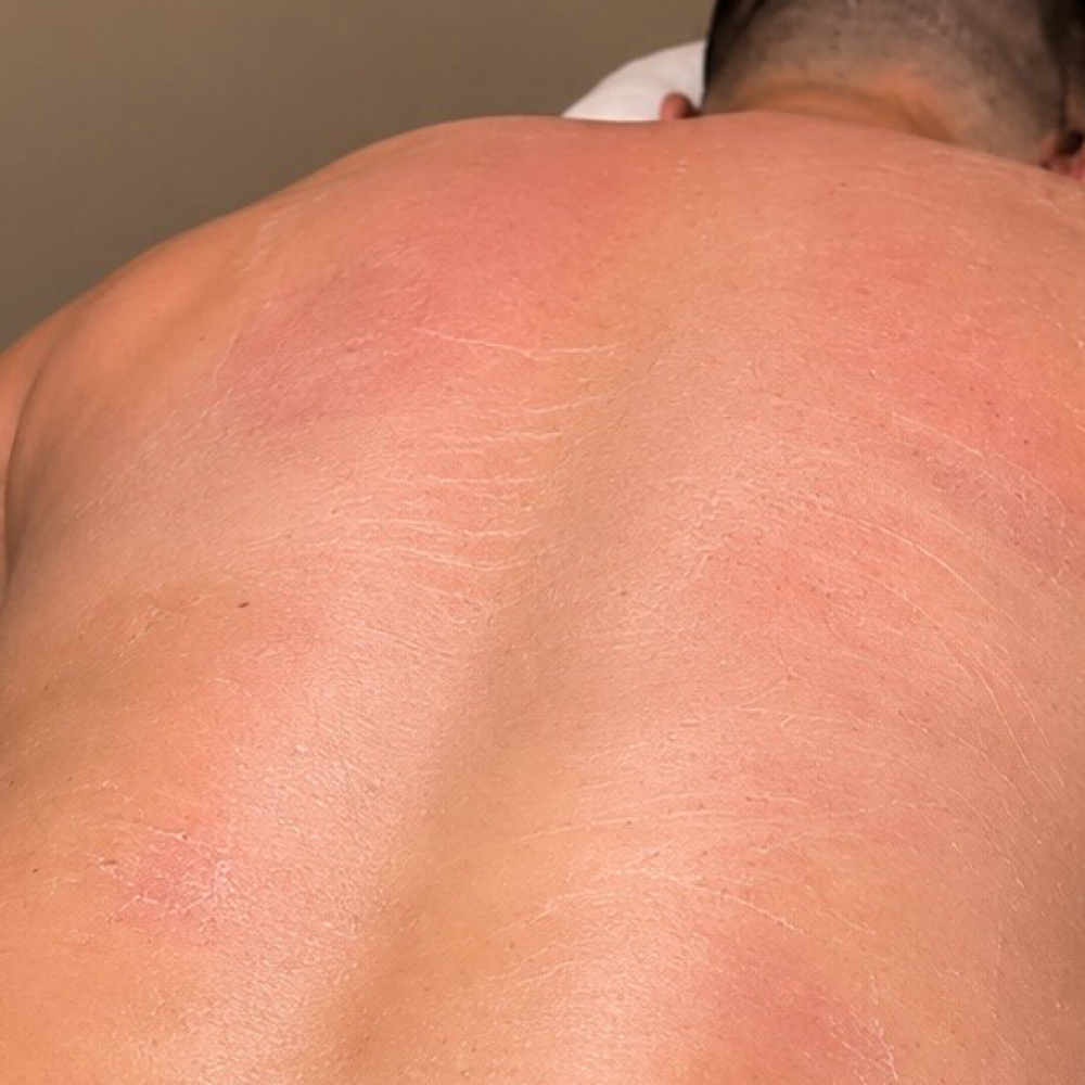 Chest Or Back Wax at Bare Beauty Esthetics in Oklahoma City, OK