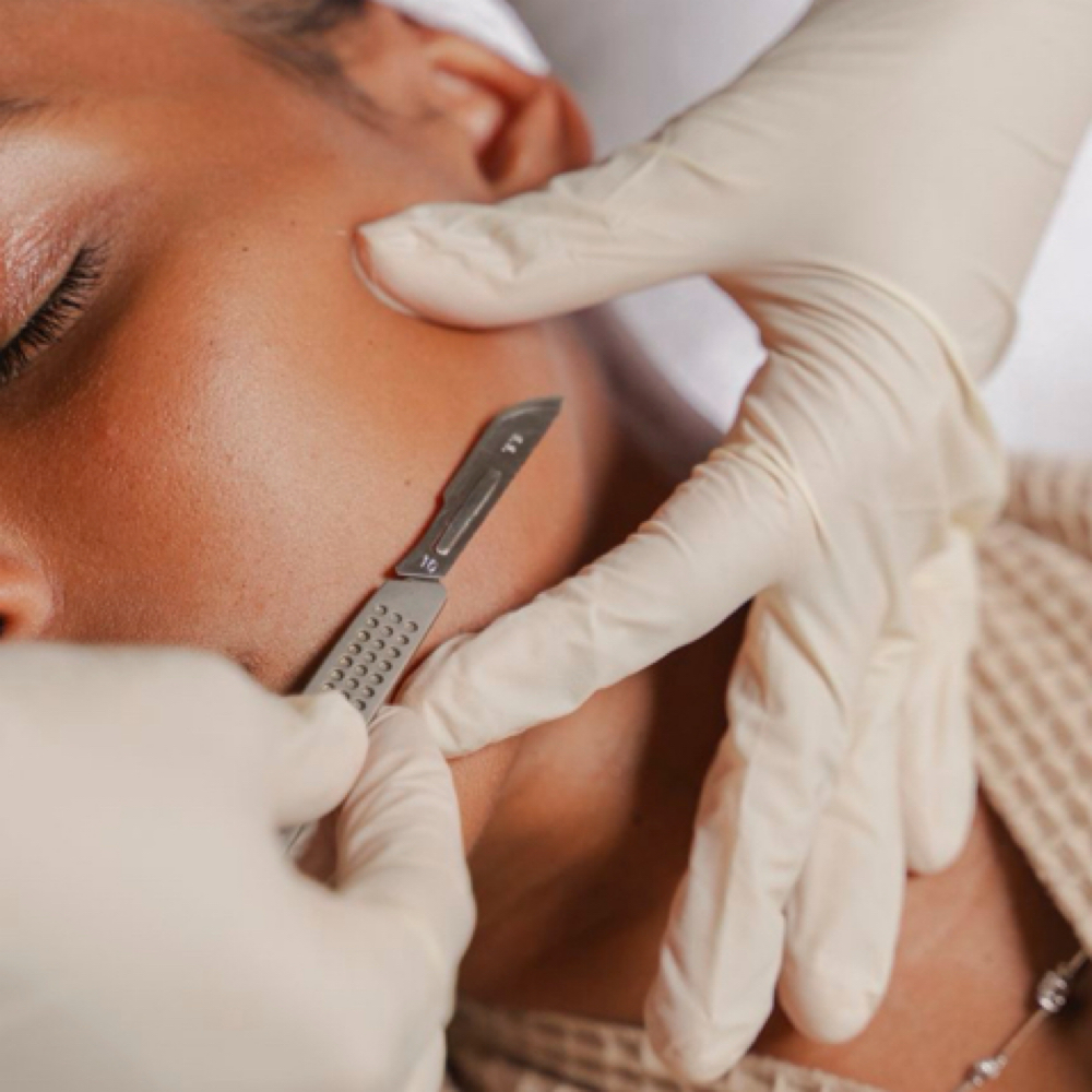Facial With Dermaplane at Étoile Briyan in Malden, MA