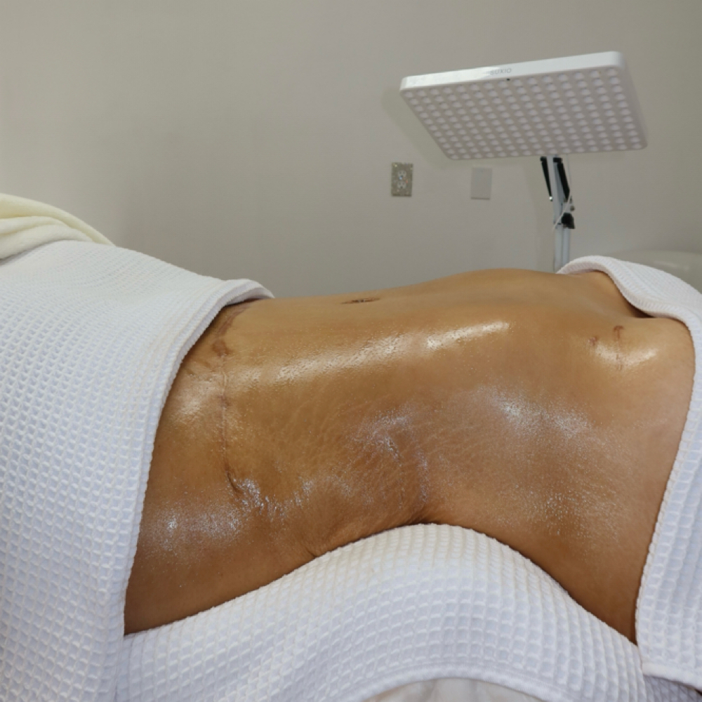 Cosmetic MLD at Luxe Beauty Studio in Cottonwood, AZ
