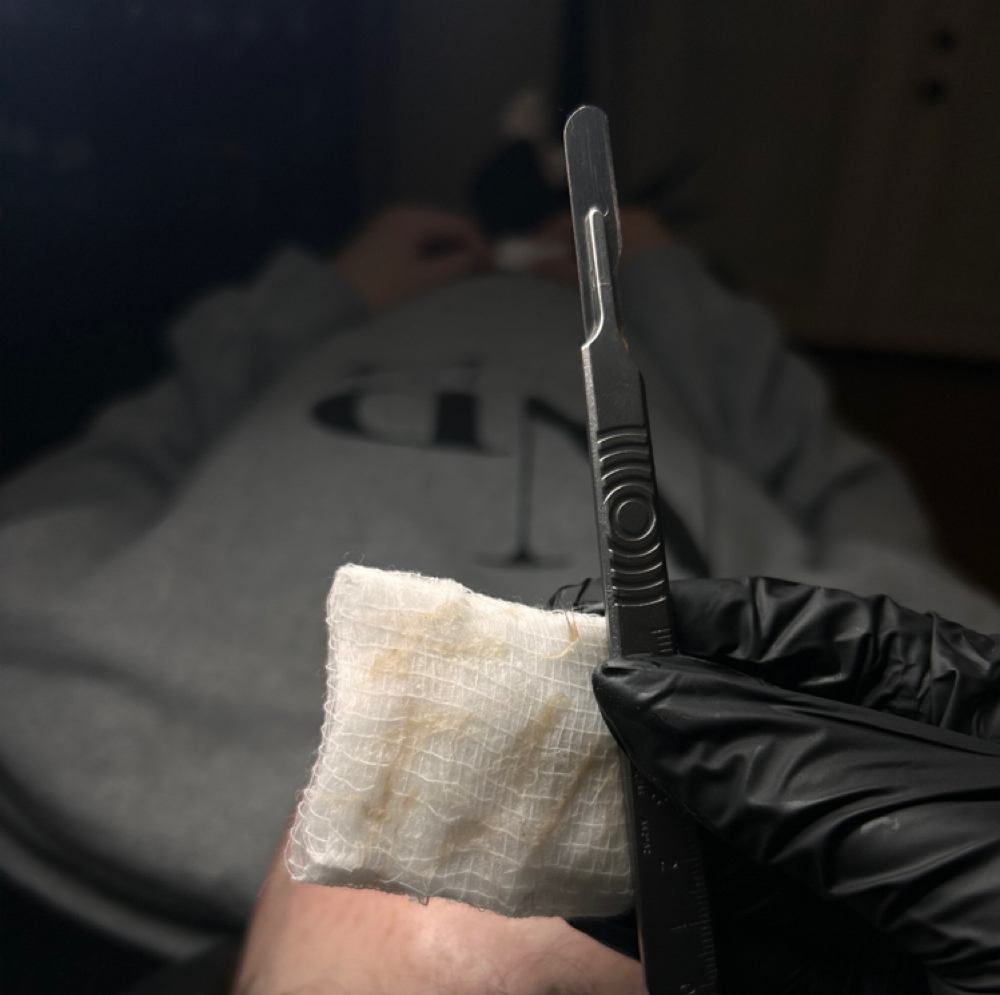 Dermaplane ADD-ON at Lyluxe SKN in Albertville, AL