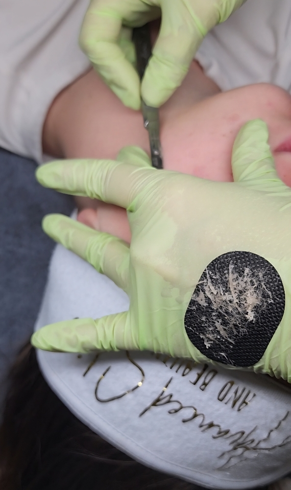 Dermaplaning Facial