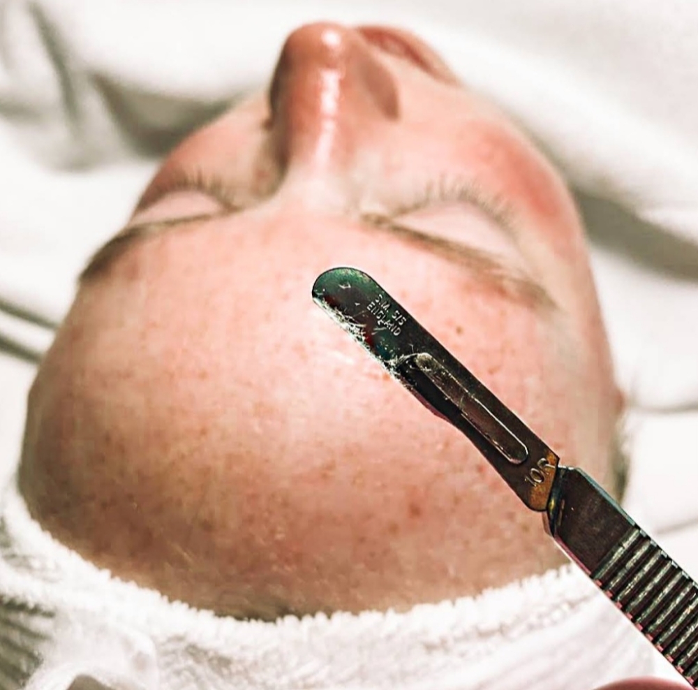 Dermaplaning Facial