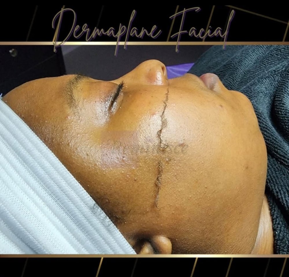 Dermaplane Add- On