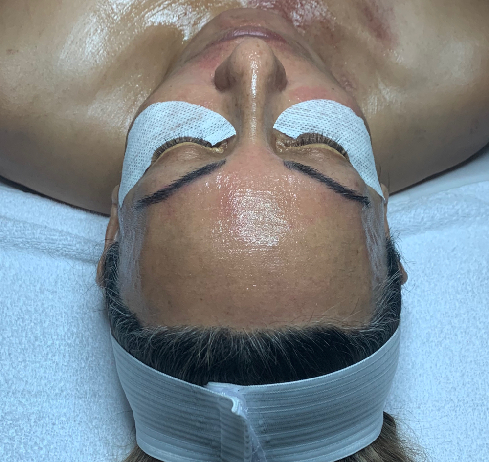 Quantum Facial